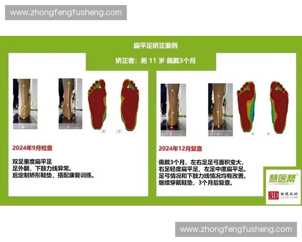 运动鞋垫科技升级全面助力舒适支撑与健康行走新体验长期呵护双足